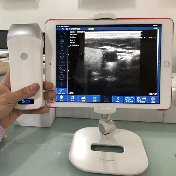 supplies chihuahua dog ultrasound corgi digital portable wireless probe pet scanner linear probe wifi android/ios windows dog hospital
supplies chihuahua dog ultrasound corgi digital portable wireless probe pet scanner linear probe wifi android/ios windows dog hospital