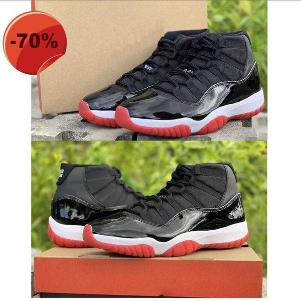 sandals real carbon fiber bred 11s basketball shoes 11 gym red gamma blue men basketball with box, Black
sandals real carbon fiber bred 11s basketball shoes 11 gym red gamma blue men basketball with box, Black