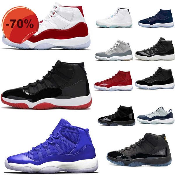 sandals with box jumpman 11 11s mens basketball shoes cool grey cap and gown gym red legend blue space jam unc jubilee bred cherry concord l, Black
sandals with box jumpman 11 11s mens basketball shoes cool grey cap and gown gym red legend blue space jam unc jubilee bred cherry concord l, Black