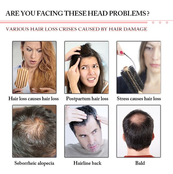 diode laser machine anti hair loss treatment for hairy regrowth reddit with 260pcs diode lamps professional cure anti loss cost for indiaian, Black
diode laser machine anti hair loss treatment for hairy regrowth reddit with 260pcs diode lamps professional cure anti loss cost for indiaian, Black