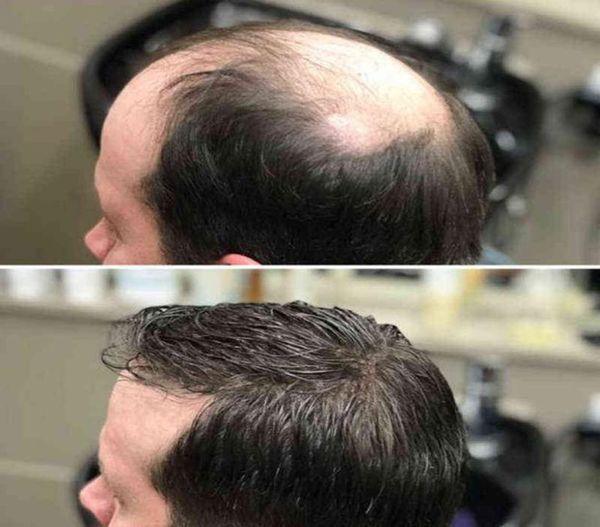 short striaght full synthetic for men male hair fleeciness realistic replacement system male for handsome 2202081948667, Black;brown
short striaght full synthetic for men male hair fleeciness realistic replacement system male for handsome 2202081948667, Black;brown