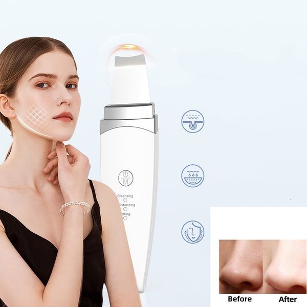 cleaning tools accessories ultrasonic skin scrubber peeling blackhead remover deep face ion ance pore cleaner shovel cleanser 230515
cleaning tools accessories ultrasonic skin scrubber peeling blackhead remover deep face ion ance pore cleaner shovel cleanser 230515