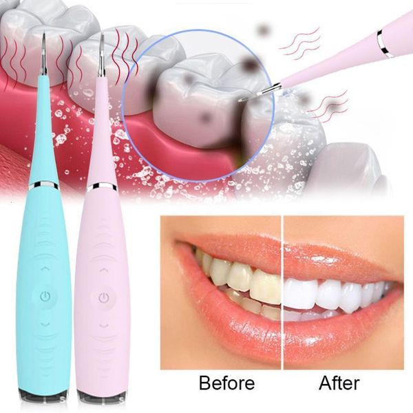 other oral hygiene electric ultrasonic tooth calculus remover cleaner tooth stains tartar whiten teeth tools drop 230516
other oral hygiene electric ultrasonic tooth calculus remover cleaner tooth stains tartar whiten teeth tools drop 230516