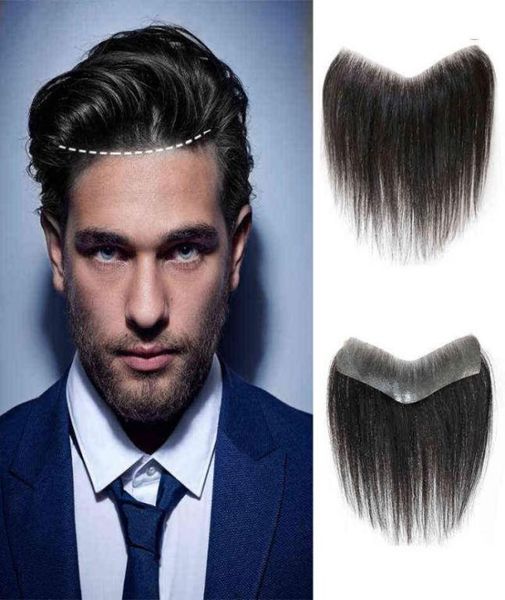 dianqi synthetic men forhead frontal natural hair piece big area v loop doublesided tape fixation front hairline for men 2202087521379, Black;brown
dianqi synthetic men forhead frontal natural hair piece big area v loop doublesided tape fixation front hairline for men 2202087521379, Black;brown