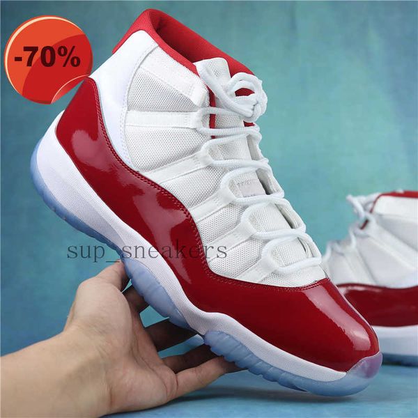 sandals with box og cherry 11 basketball shoes mens womans fashion breathable high basketball sneakers bred cool grey concord 11s massage pl, Black
sandals with box og cherry 11 basketball shoes mens womans fashion breathable high basketball sneakers bred cool grey concord 11s massage pl, Black