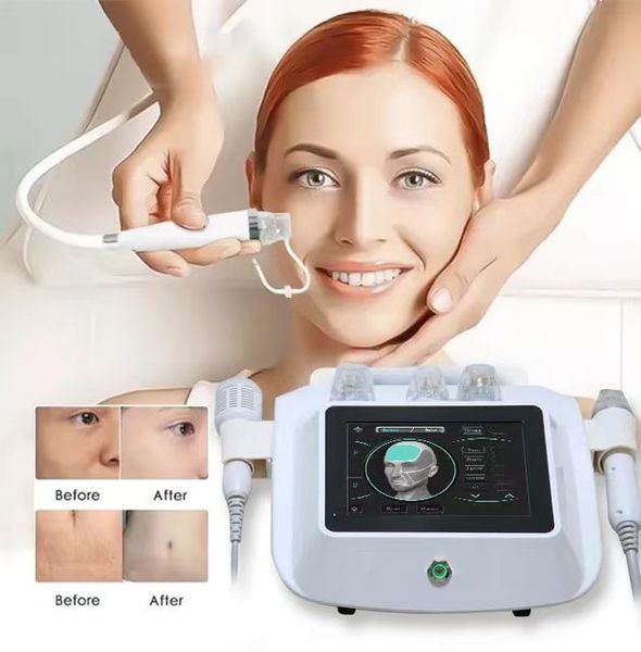 2023 morpheus 8 mikron adel fractional mikron adel rf hochfrequenz face lifting wrinkle removal hauts traffung salon verwenden beauty-maschi
2023 morpheus 8 mikron adel fractional mikron adel rf hochfrequenz face lifting wrinkle removal hauts traffung salon verwenden beauty-maschi