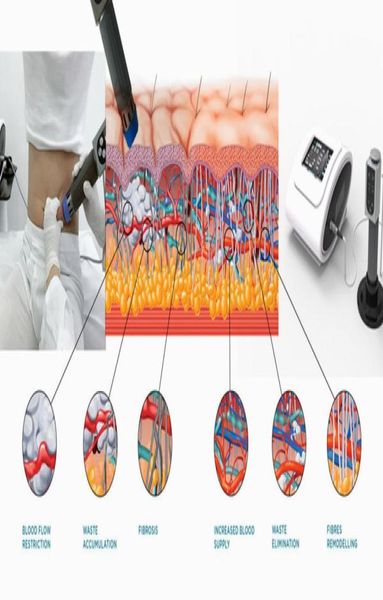 portable massage physical shock wave therapy machine reduce body fat good quality shockwave therapy machine for body slimming9314940
portable massage physical shock wave therapy machine reduce body fat good quality shockwave therapy machine for body slimming9314940
