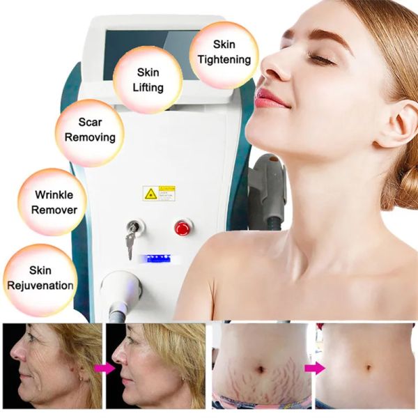 opt/ipl/q switch hair removal beauty items ance treatment skin rejuvenation and whitening beauty salon/home
opt/ipl/q switch hair removal beauty items ance treatment skin rejuvenation and whitening beauty salon/home