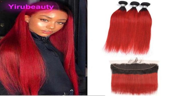 peruvian human hair 3 bundles with 13x4 lace frontal with baby hair 1bred straight bundles with 134 frontal straight whole1796647, Black;brown
peruvian human hair 3 bundles with 13x4 lace frontal with baby hair 1bred straight bundles with 134 frontal straight whole1796647, Black;brown