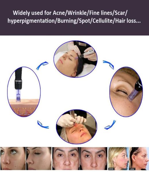 professional derma roller pen micro needle meso pen drpen microneedle with different needles cartridge derma skin pen with factor7892026
professional derma roller pen micro needle meso pen drpen microneedle with different needles cartridge derma skin pen with factor7892026