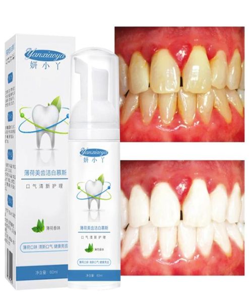 tooth mousse toothpaste clean whitening remove dental plaque tea stains dirt oral hygiene mint vitamin c dental care tools 60ml6045272
tooth mousse toothpaste clean whitening remove dental plaque tea stains dirt oral hygiene mint vitamin c dental care tools 60ml6045272
