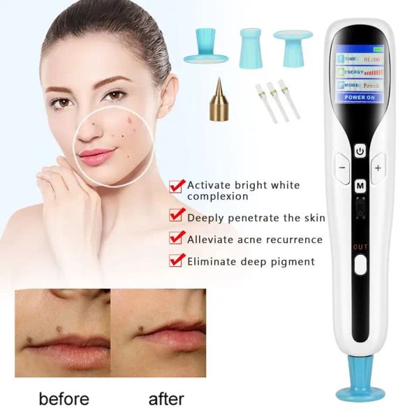 skin tightening mole wrinkle removal peneyelid medical plaspot eyelid lift plasma surgical lift pen, Black
skin tightening mole wrinkle removal peneyelid medical plaspot eyelid lift plasma surgical lift pen, Black