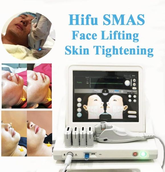 hifu smas lifting machine face neck wrinkle removal weight loss high intensity focused ultrasound body slimming1951632
hifu smas lifting machine face neck wrinkle removal weight loss high intensity focused ultrasound body slimming1951632