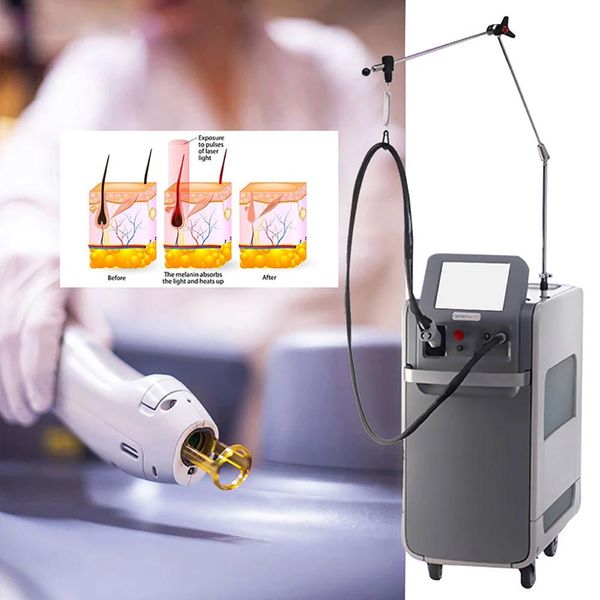 epilator candella pro max gentle alexandrite laser hair removal machine 755nm long pule nd yag laser 1064nm rejuvenation beauty machine
epilator candella pro max gentle alexandrite laser hair removal machine 755nm long pule nd yag laser 1064nm rejuvenation beauty machine