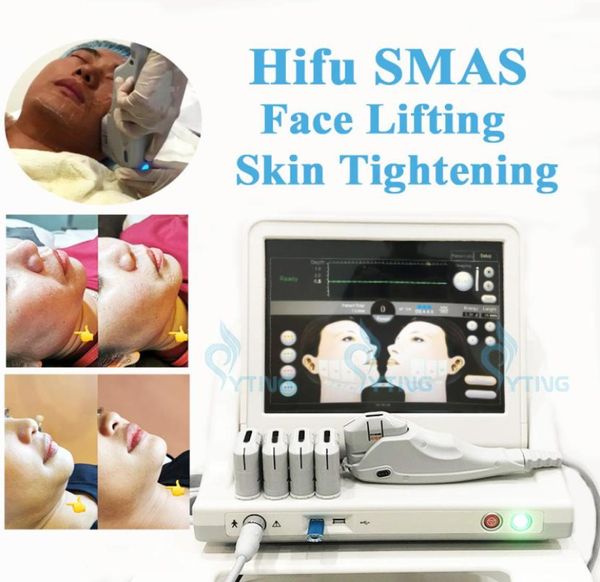 hifu ultrasound skin lifting system beauty equipment 10000 ss body slimming weight loss skin care anti aging8058407
hifu ultrasound skin lifting system beauty equipment 10000 ss body slimming weight loss skin care anti aging8058407