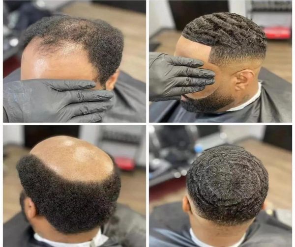 10mm 6mm deep curly toupee human hair skin thin base unit system men hairpiece pu 360 wave afro male toupees replacement for man2370904, Black
10mm 6mm deep curly toupee human hair skin thin base unit system men hairpiece pu 360 wave afro male toupees replacement for man2370904, Black