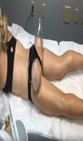 multifunctional slimming instrument vacuum breast enlargement therapy cupping device butt lifting hip lift massage machine enhance6718937
multifunctional slimming instrument vacuum breast enlargement therapy cupping device butt lifting hip lift massage machine enhance6718937