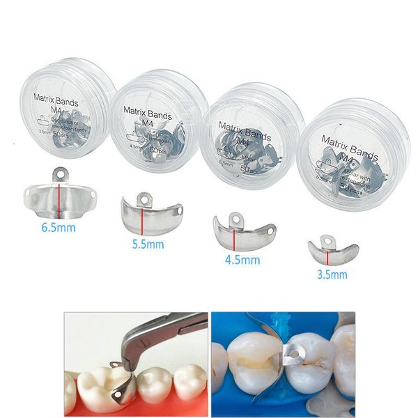 magnifying glasses 50pcs dental metal matrices bands with holes sectional contoured tofflemire stuck dentist tools 230701
magnifying glasses 50pcs dental metal matrices bands with holes sectional contoured tofflemire stuck dentist tools 230701