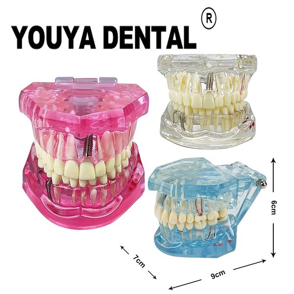 Other Oral Hygiene Teeth Repair Model Disease for Dentist Student Practice Training Studying Dentistry Tools 230704
Other Oral Hygiene Teeth Repair Model Disease for Dentist Student Practice Training Studying Dentistry Tools 230704