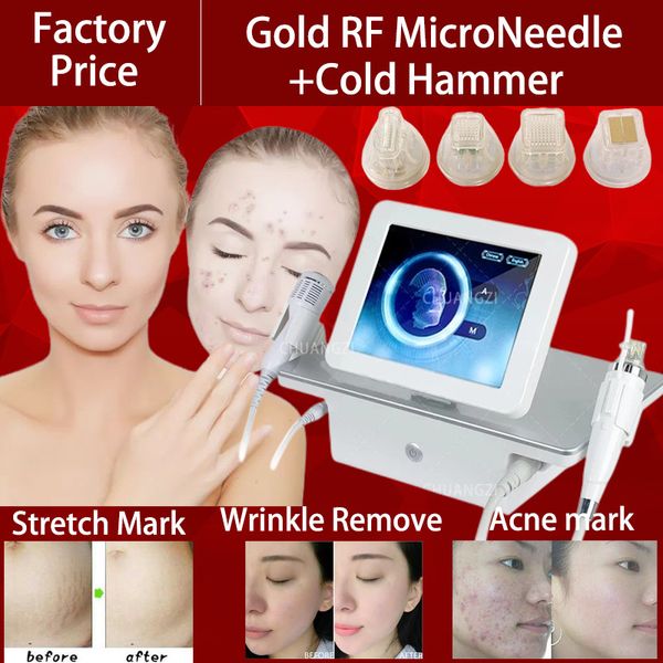 fractional gold rf microneedle beauty machine facial equip face liftting stretch mark acne wrinkle removal needl salon
fractional gold rf microneedle beauty machine facial equip face liftting stretch mark acne wrinkle removal needl salon