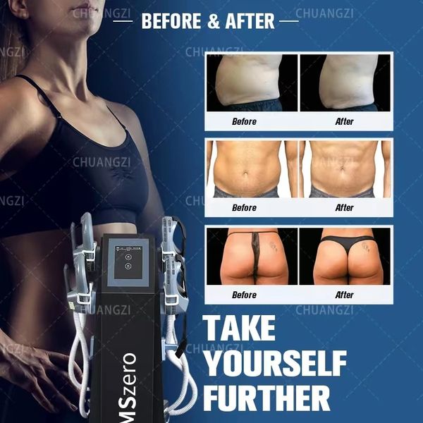 emszero neo 14 tesla 6500w hi-emt body sculpting machine nova muscle stimulator shaping equipment for salon rf
emszero neo 14 tesla 6500w hi-emt body sculpting machine nova muscle stimulator shaping equipment for salon rf