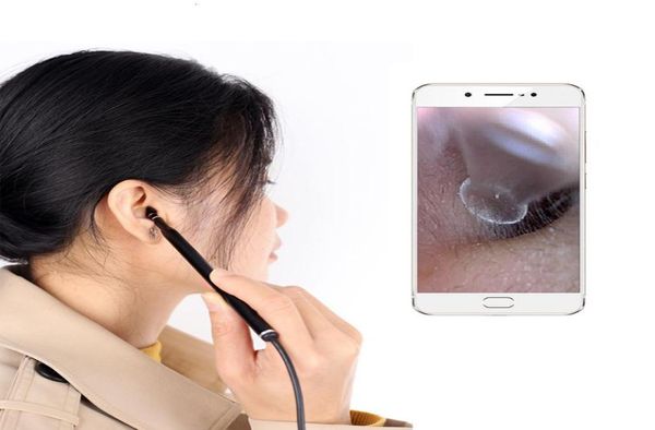 android pc ios high resolution usb endoscope otoscope vision ear cleaning tool camera earpick endoscope for medical5636650
android pc ios high resolution usb endoscope otoscope vision ear cleaning tool camera earpick endoscope for medical5636650