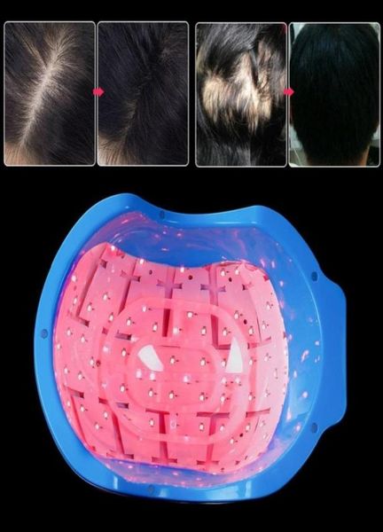 new laser cap hair growth laser cap diodes hair loss treatment lllt laser hair loss regrowth growth therapy treatment machine1294289, Black
new laser cap hair growth laser cap diodes hair loss treatment lllt laser hair loss regrowth growth therapy treatment machine1294289, Black