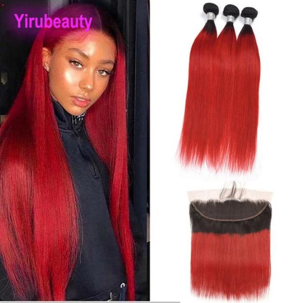 peruvian human hair 3 bundles with 13x4 lace frontal with baby hair 1bred straight bundles with 134 frontal straight whole1825636, Black;brown
peruvian human hair 3 bundles with 13x4 lace frontal with baby hair 1bred straight bundles with 134 frontal straight whole1825636, Black;brown