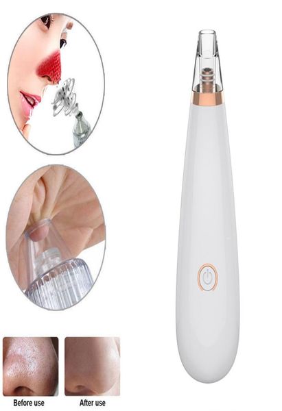electronic blackhead remover vacuum suction facial acnepore cleaner extractor portable household pore beauty1470725
electronic blackhead remover vacuum suction facial acnepore cleaner extractor portable household pore beauty1470725