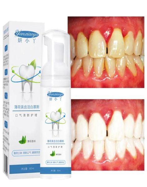 tooth mousse toothpaste clean whitening remove dental plaque tea stains dirt oral hygiene mint vitamin c dental care tools 60ml7792021
tooth mousse toothpaste clean whitening remove dental plaque tea stains dirt oral hygiene mint vitamin c dental care tools 60ml7792021