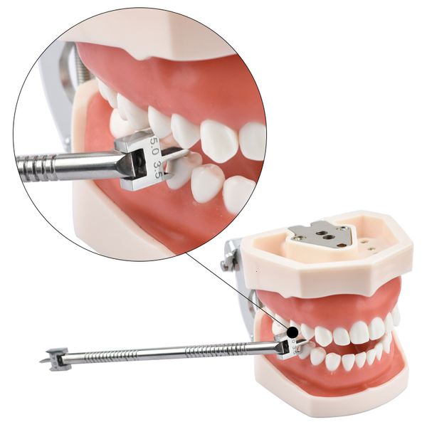 other oral hygiene dental bracket gauge locator stainless steel double scale orthodontic brackets positioner instruments size 4 0 4 5 and 5
other oral hygiene dental bracket gauge locator stainless steel double scale orthodontic brackets positioner instruments size 4 0 4 5 and 5