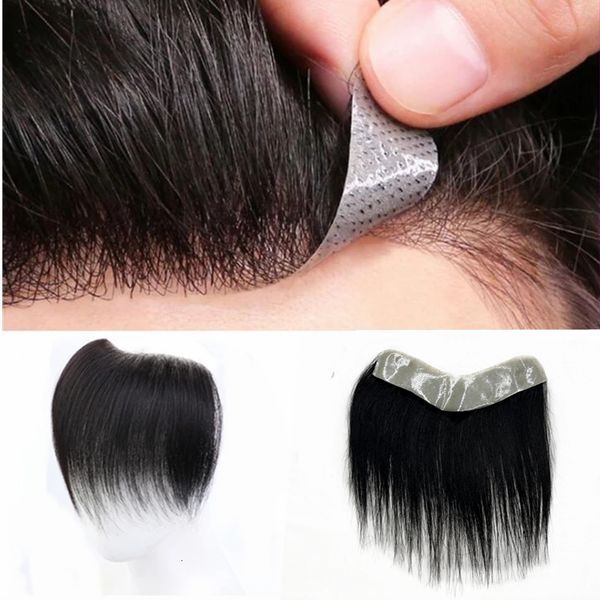 bangs v shape forehead human hair line frontal hairpiece for men with tapes brazilian natural hair replacement for baldness non-remy 230724, Black
bangs v shape forehead human hair line frontal hairpiece for men with tapes brazilian natural hair replacement for baldness non-remy 230724, Black