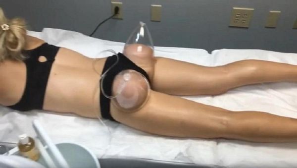 multifunctional slimming instrument vacuum breast enlargement therapy cupping device butt lifting hip lift massage machine enhance9709376
multifunctional slimming instrument vacuum breast enlargement therapy cupping device butt lifting hip lift massage machine enhance9709376