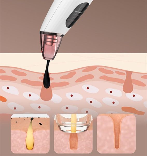 blackhead instrument home handheld portable facial skin cleaner blackhead exporter6021218
blackhead instrument home handheld portable facial skin cleaner blackhead exporter6021218