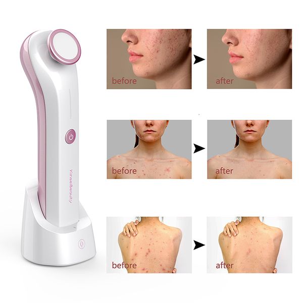 face care devices blue light laser massager ozone treatment cold plasma pen scar acne removal machine anti wrinkle skin beauty device 230729
face care devices blue light laser massager ozone treatment cold plasma pen scar acne removal machine anti wrinkle skin beauty device 230729