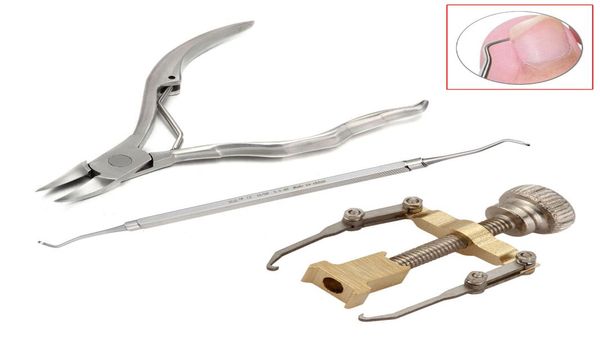 whole 3pcsset stainless steel cuticle nipper nail clipper ingrown toe nail correction tool nail art correction manicure2056147
whole 3pcsset stainless steel cuticle nipper nail clipper ingrown toe nail correction tool nail art correction manicure2056147
