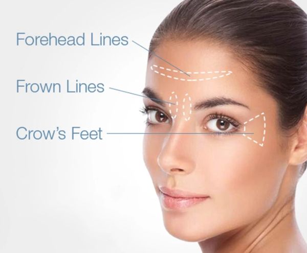face care devices wrinkle-removal for body derma meso salon juydms cream vollummes for face skin rejuvenation juvvydms skin care creams ullt
face care devices wrinkle-removal for body derma meso salon juydms cream vollummes for face skin rejuvenation juvvydms skin care creams ullt