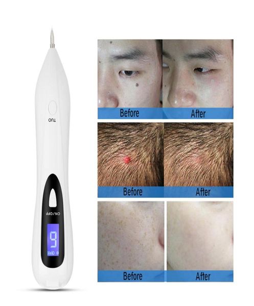 laser plasma pen mole removal dark spot remover lcd skin care point wart tag tattoo tool beauty6327054
laser plasma pen mole removal dark spot remover lcd skin care point wart tag tattoo tool beauty6327054