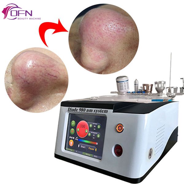 portable 6 in 1 vascular removal nails fungus removal physiotherapy skin rejuvenation evlt 980nm laser machine, Black
portable 6 in 1 vascular removal nails fungus removal physiotherapy skin rejuvenation evlt 980nm laser machine, Black