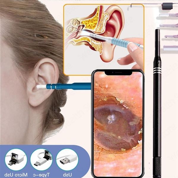 other health beauty items ear cleaner endoscope camera otoscope for medical pick kit cleaning ear wax removal tool candle sticks e322o
other health beauty items ear cleaner endoscope camera otoscope for medical pick kit cleaning ear wax removal tool candle sticks e322o
