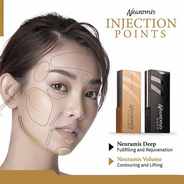 south korea original injectable dermal filler neuramis 20mg/ml with lido sliver color deep volume for lip face cheek chin enhance injection
south korea original injectable dermal filler neuramis 20mg/ml with lido sliver color deep volume for lip face cheek chin enhance injection