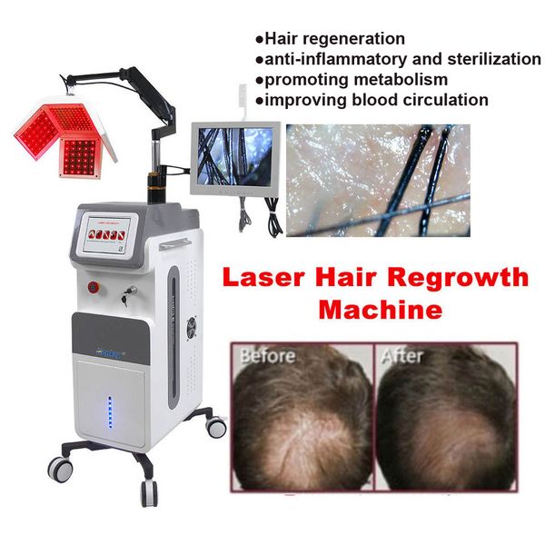 hair loss treatment laser machine 650nm low level hairs regrowth laser equipment for clinic with skin analysis camera anti hair loss spa ins, Black
hair loss treatment laser machine 650nm low level hairs regrowth laser equipment for clinic with skin analysis camera anti hair loss spa ins, Black