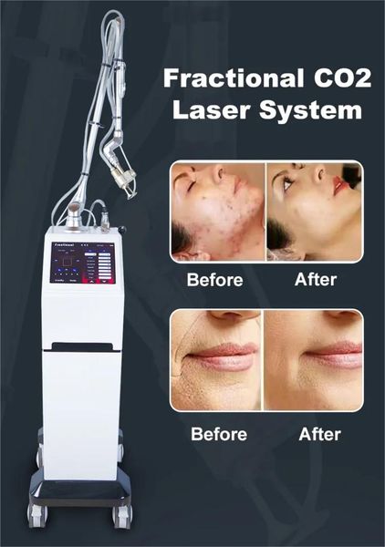 sale skin resurfacing 10600nm co2 fractional laser machine scar removal beauty equipment, Black
sale skin resurfacing 10600nm co2 fractional laser machine scar removal beauty equipment, Black