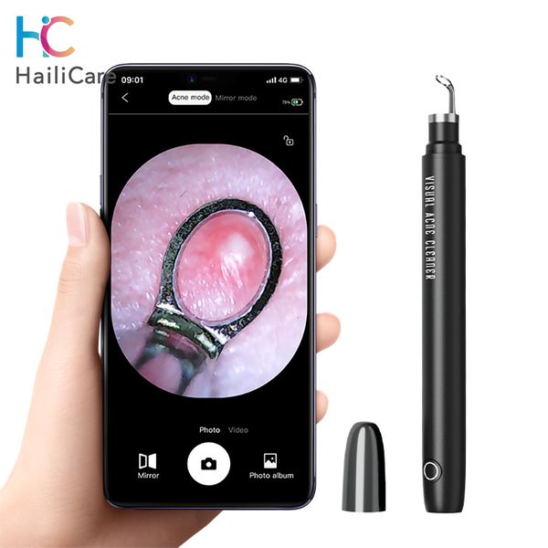 face care devices visual blackhead remover nose black head dot removal pen mini camera cleaning tools ctor pimples skin 230214
face care devices visual blackhead remover nose black head dot removal pen mini camera cleaning tools ctor pimples skin 230214