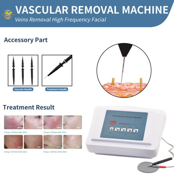laser machine class iv deep tissue laser therapy for pain relief 980nm diode laser machine, Black
laser machine class iv deep tissue laser therapy for pain relief 980nm diode laser machine, Black
