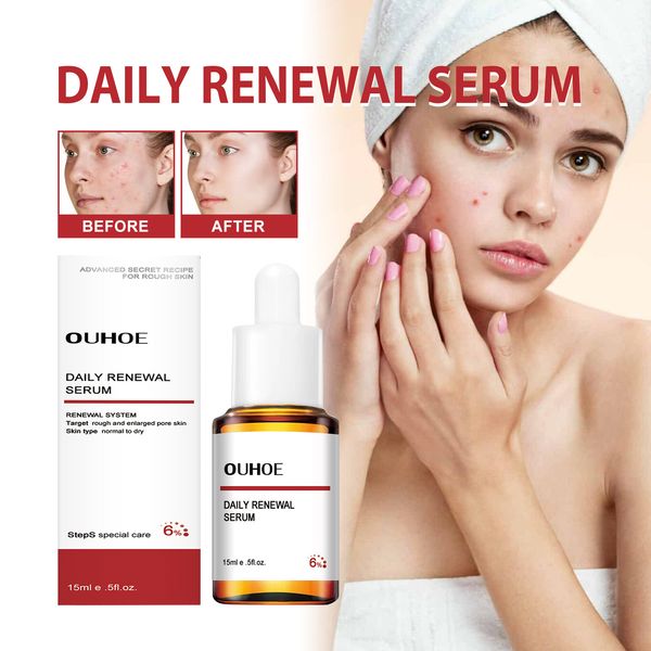 almond acid acne remover skin brightening anti aging serum dark spot essential oil for acne folliculitis prone skin 15ml
almond acid acne remover skin brightening anti aging serum dark spot essential oil for acne folliculitis prone skin 15ml