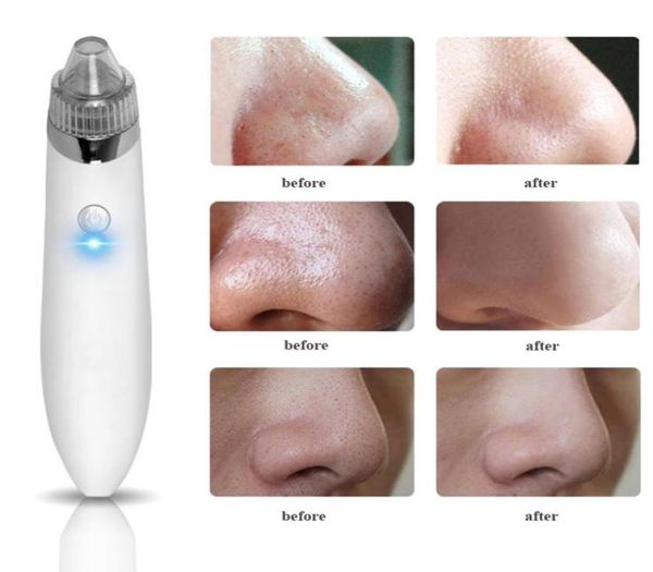 electric usb charge vacuum blackhead removal acne blemish remover device blackhead extractor nose blackhead cleaner tool8483554
electric usb charge vacuum blackhead removal acne blemish remover device blackhead extractor nose blackhead cleaner tool8483554