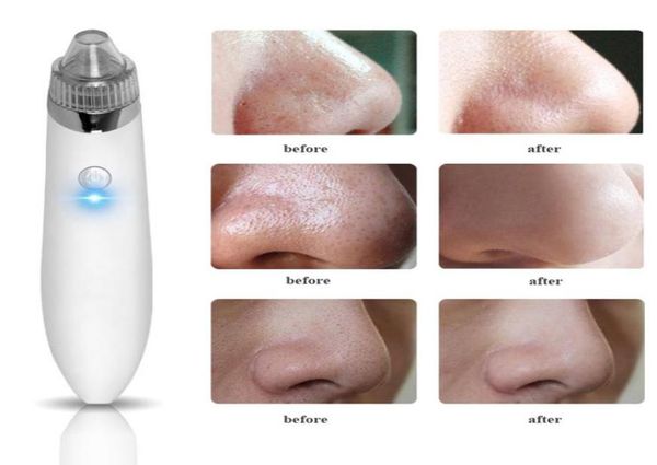 electric usb charge vacuum blackhead removal acne blemish remover device blackhead extractor nose blackhead cleaner tool7058239
electric usb charge vacuum blackhead removal acne blemish remover device blackhead extractor nose blackhead cleaner tool7058239