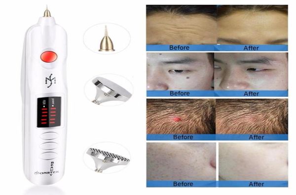 2019 most factory korea beauty monster plasma lift pen plasma jett for spot and mole removal1455598, Black
2019 most factory korea beauty monster plasma lift pen plasma jett for spot and mole removal1455598, Black