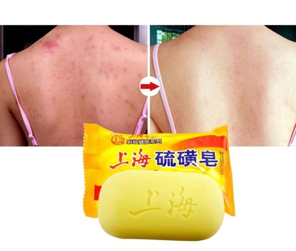 85g shanghai sulfur soap oil control acne treatment psoriasis seborrhea eczema anti fungus bath healthy soap1246475
85g shanghai sulfur soap oil control acne treatment psoriasis seborrhea eczema anti fungus bath healthy soap1246475